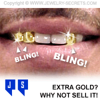 Sell Solid Gold Teeth Equals Money