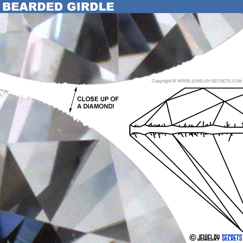 What's a Bearded Diamond Girdle?