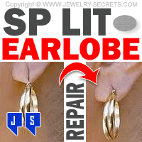 Split Earlobe Repair Patches Split Earlobe Repair Patches